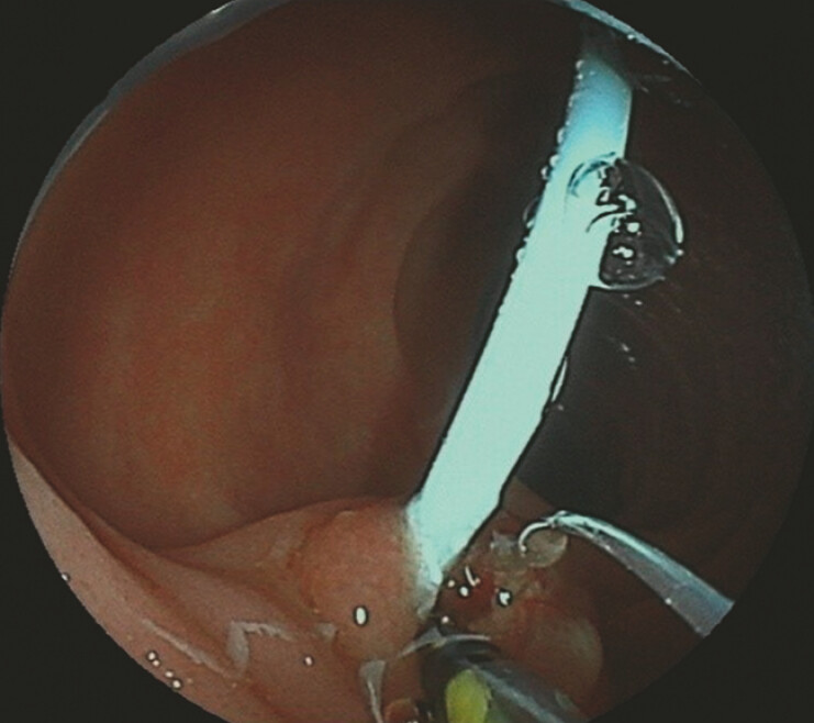 Fig. 4
