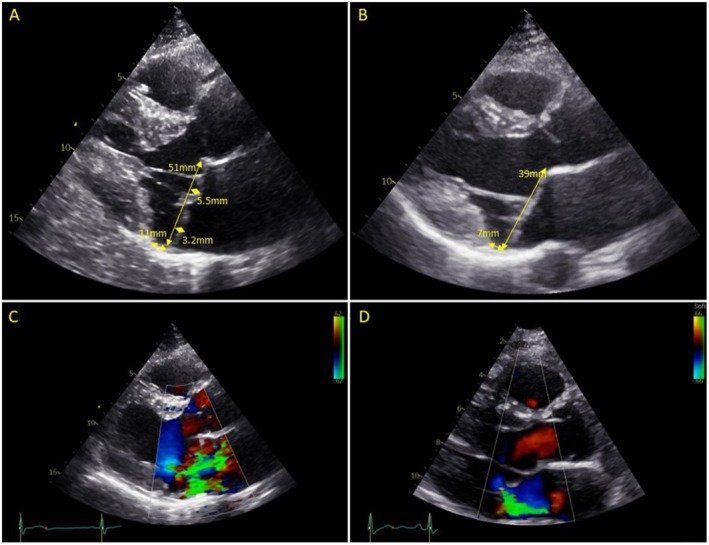 FIGURE 2