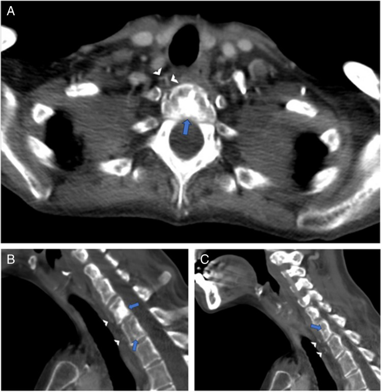 Figure 6