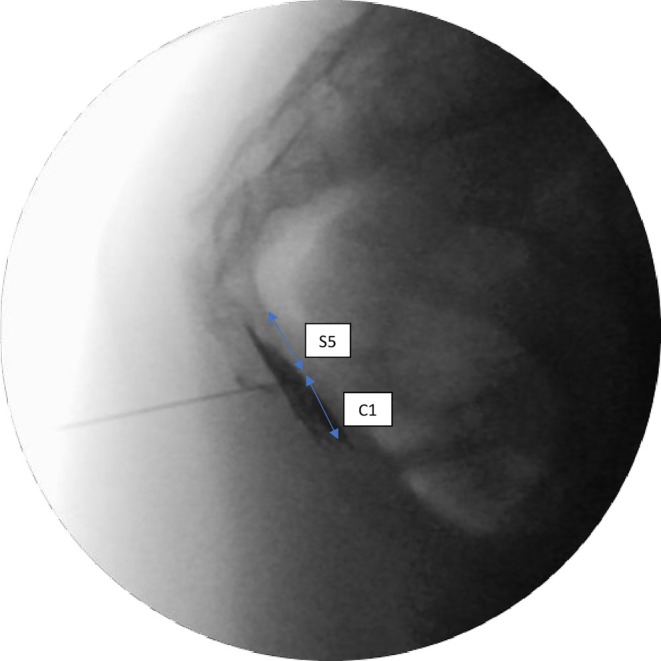 FIGURE 3