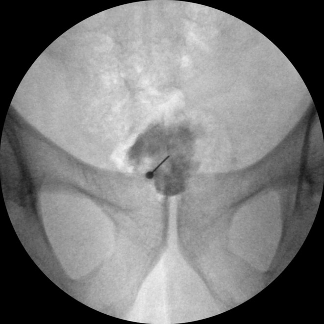 FIGURE 4