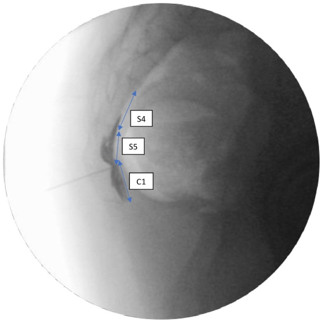 FIGURE 2