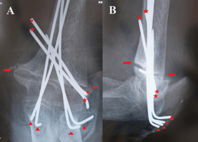 Figure 7
