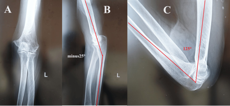 Figure 10