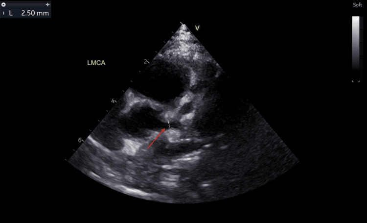 Figure 9