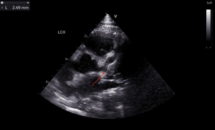 Figure 10