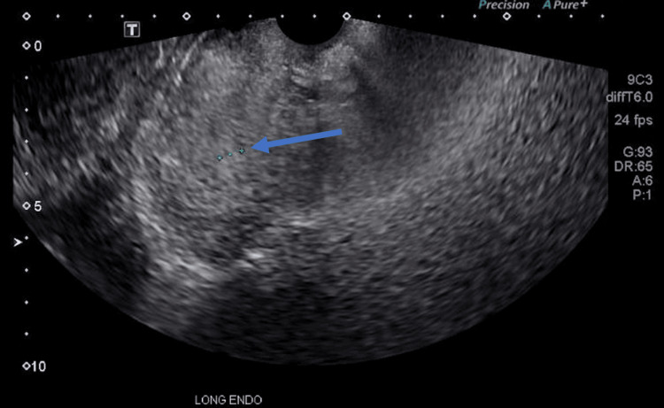 Figure 5