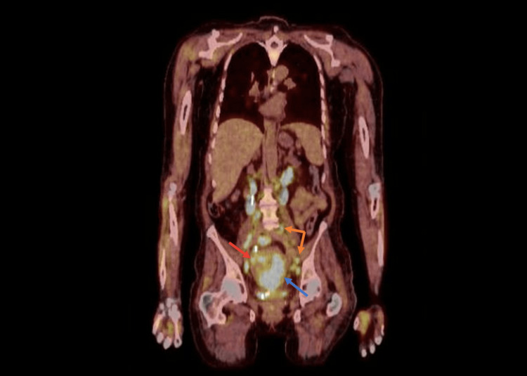 Figure 10