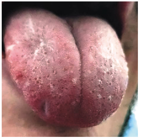 Figure 2