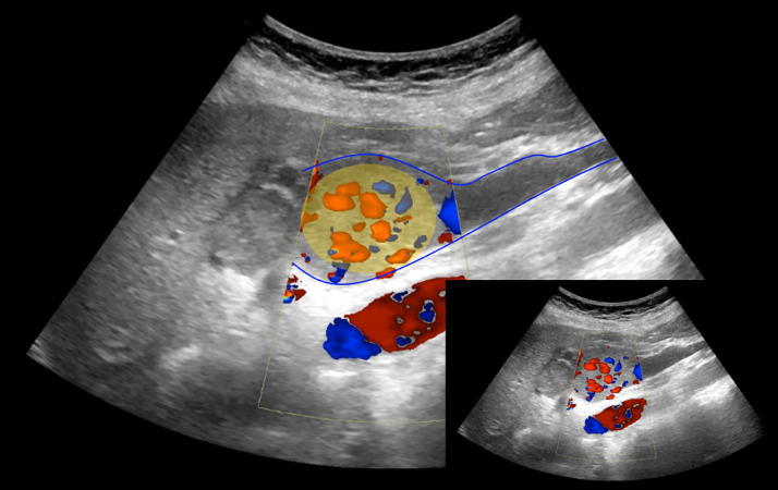 Figure 5