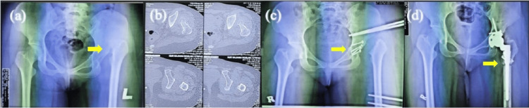 Figure 5