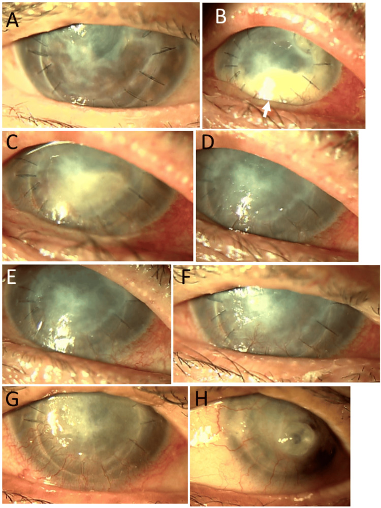 Figure 6