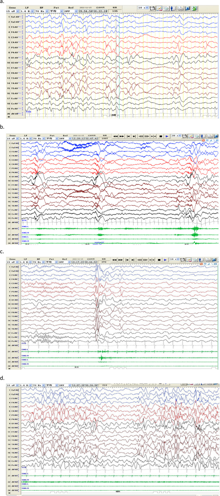 Figure 4