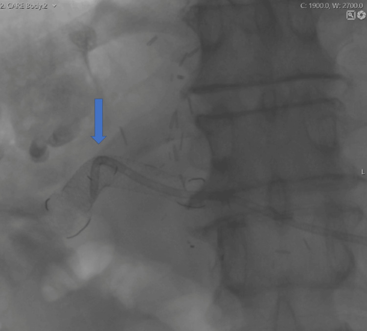 Figure 10