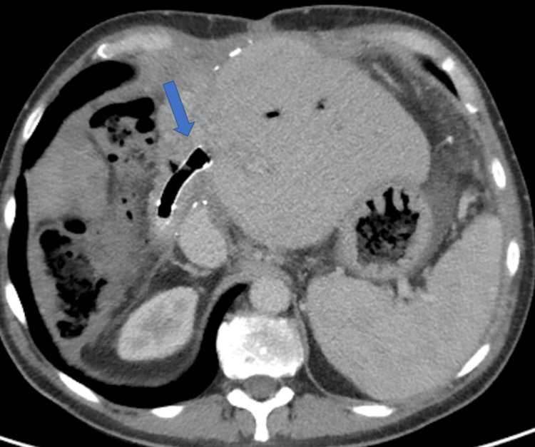 Figure 11