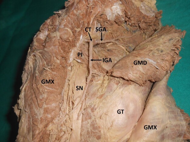 Figure 9