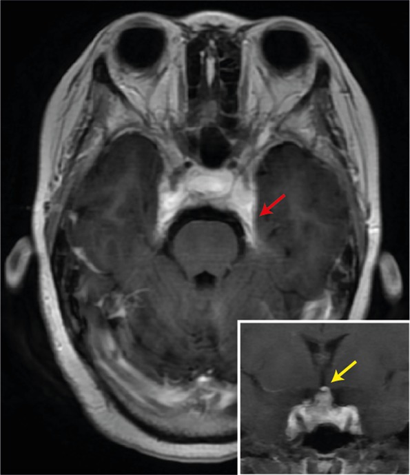 FIGURE 1