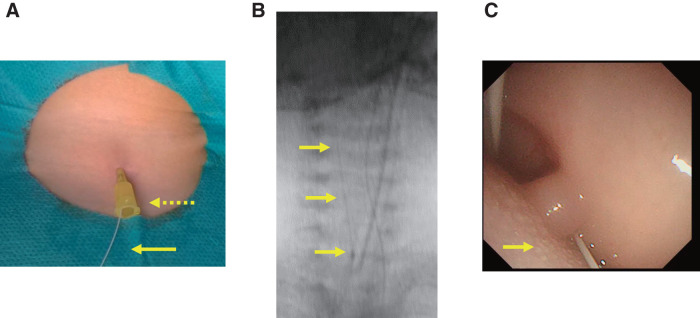 Fig. 2