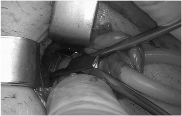 FIGURE 3