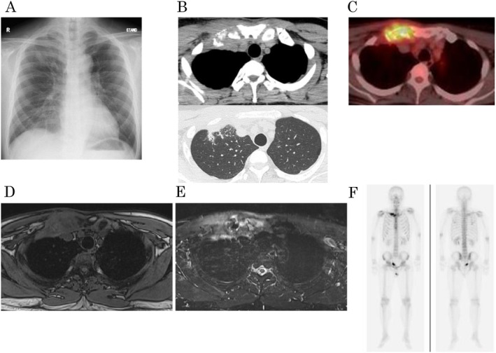 FIGURE 1