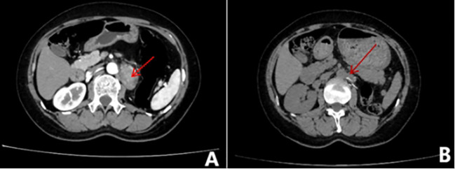 Figure 2