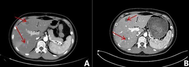 Figure 4