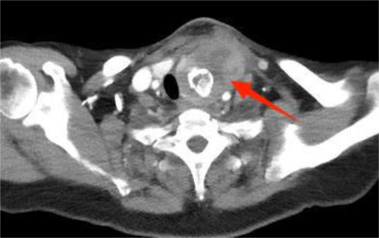 Figure 1