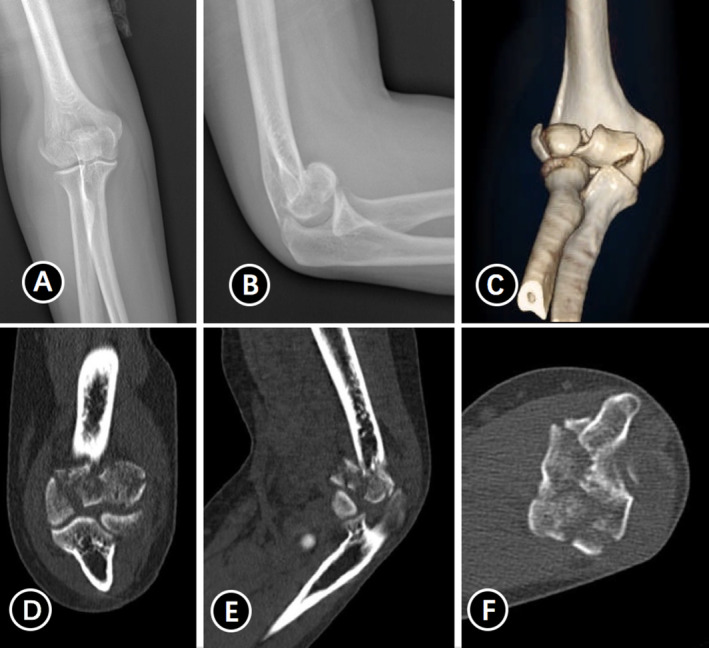 FIGURE 2