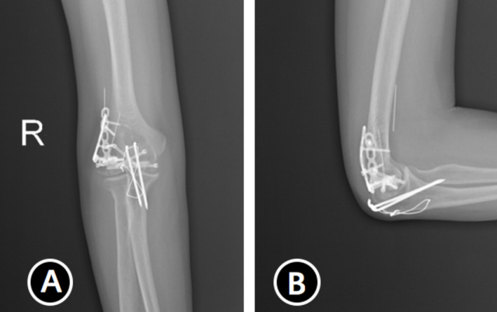 FIGURE 6