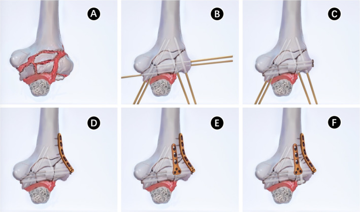 FIGURE 3