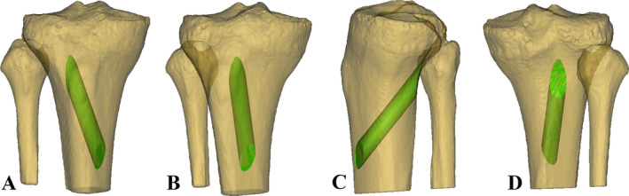 FIGURE 3