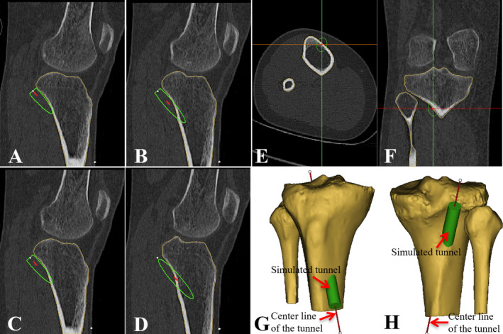 FIGURE 2