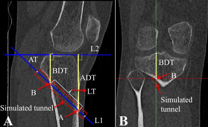 FIGURE 1