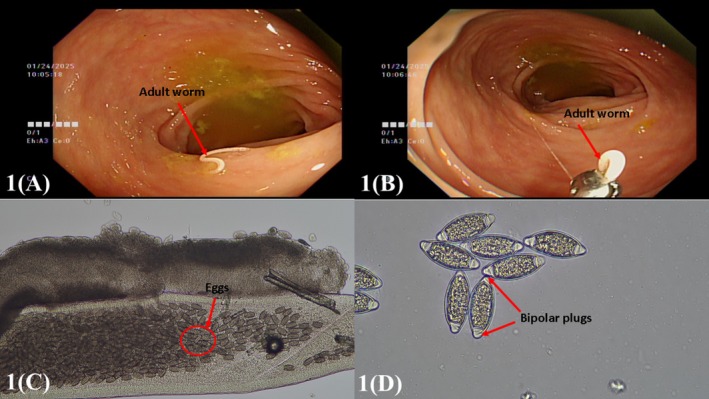 FIGURE 1