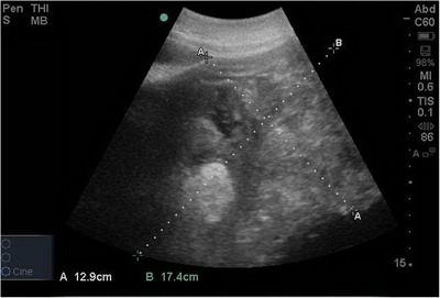 FIGURE 1
