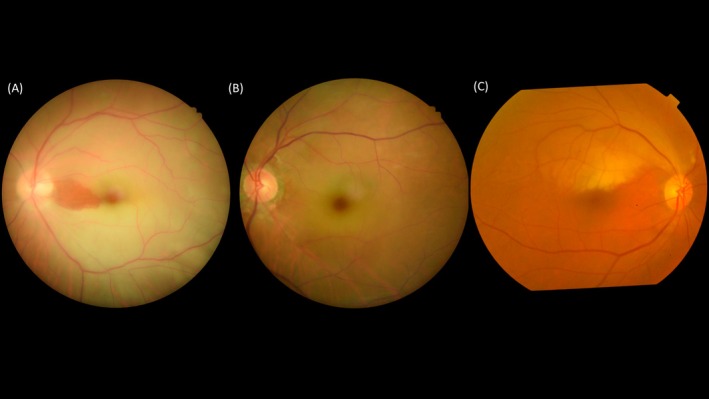 FIGURE 1