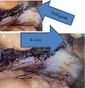 Figure 6