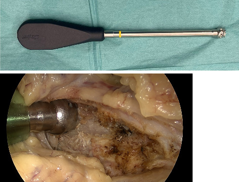 Figure 10