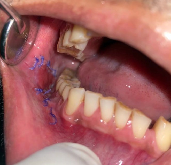FIGURE 13
