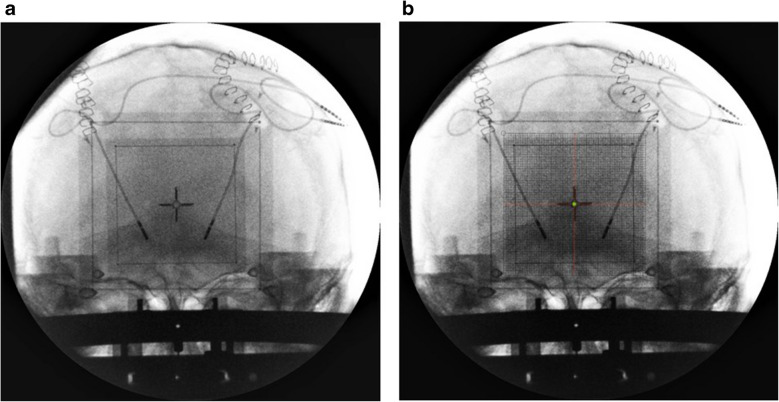 Figure 10