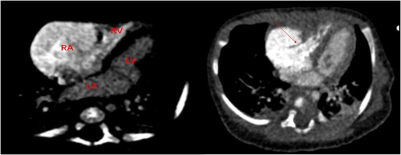 Figure 4