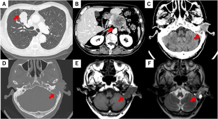 FIGURE 2