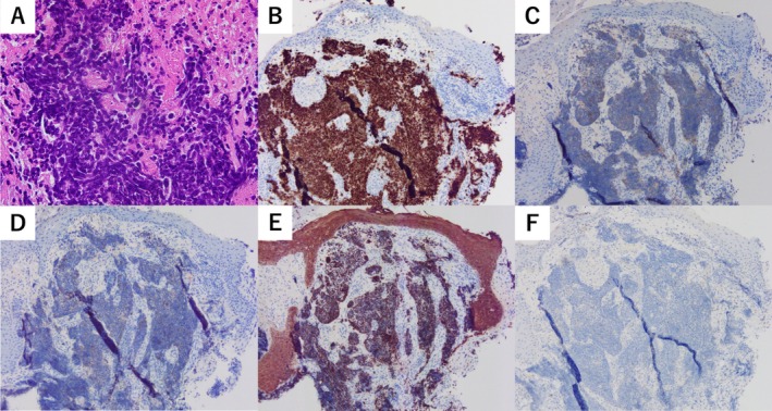 FIGURE 4