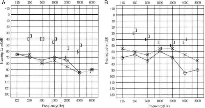 FIGURE 3