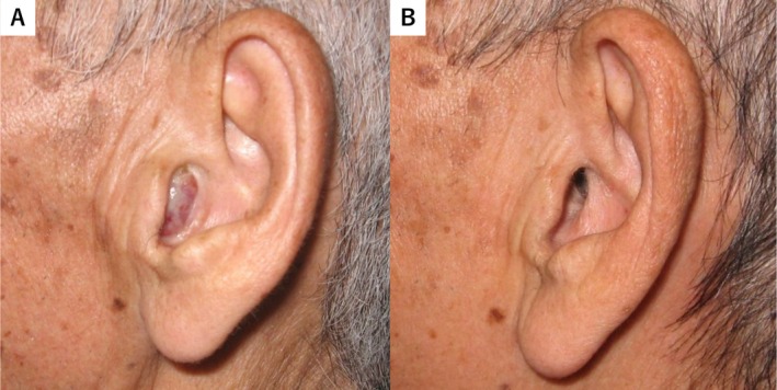 FIGURE 1