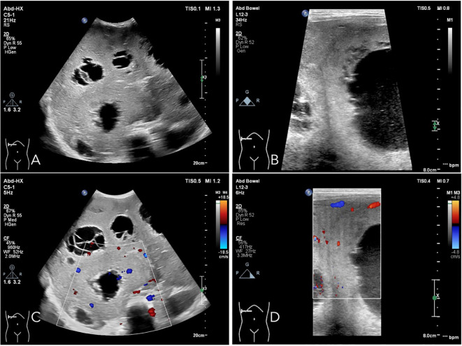 Figure 2