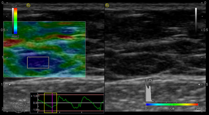 Figure 3
