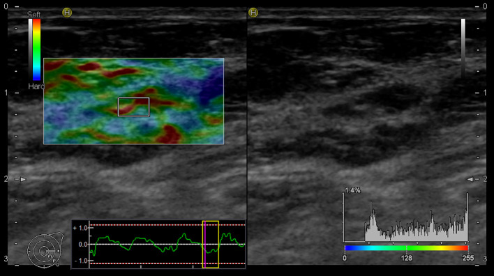 Figure 4