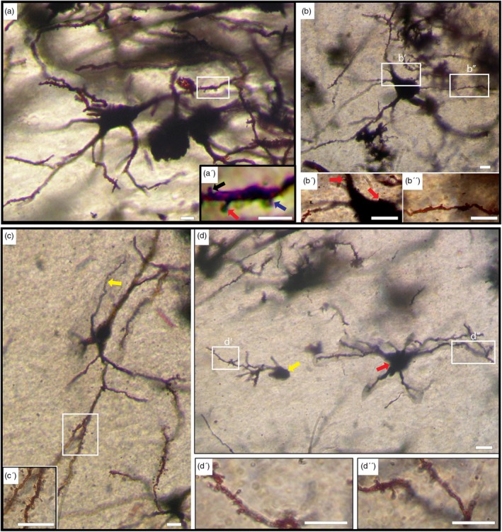 FIGURE 3