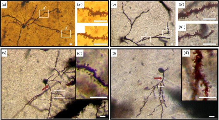 FIGURE 2